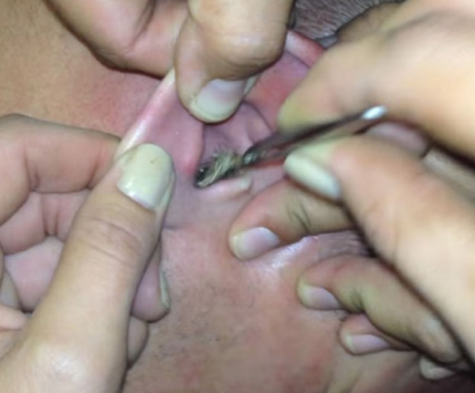 ear 3